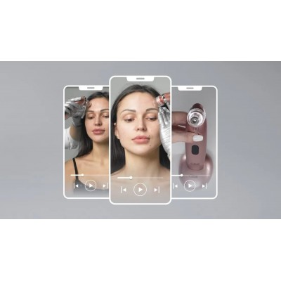 Аппарат для вакуумной чистки и шлифовки c микрокамерой GESS Sleek