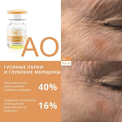 Биореструктуризант для лица ARES AO Anti Oxidant 4 x 4мл