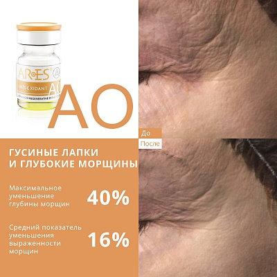 Биореструктуризант для лица ARES AO Anti Oxidant 4 x 4мл