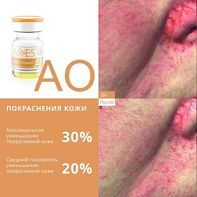 Биореструктуризант для лица ARES AO Anti Oxidant 4 x 4мл