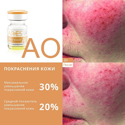 Биореструктуризант для лица ARES AO Anti Oxidant 4 x 4мл