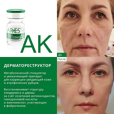 Биореструктуризант для лица ARES AK Dermo Restructurant 4мл
