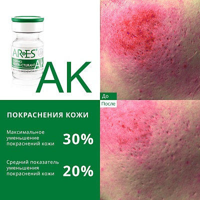 Биореструктуризант для лица ARES AK Dermo Restructurant 4мл