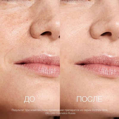 Крем для лица 24ч с эффектом ботокса ELDAN Biothox-time 250 мл