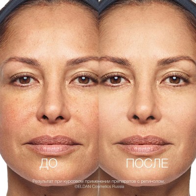 Восстанавливающая маска для лица с ретинолом 0,5% ELDAN RETINOL AGE PERFECT обновление кожи 200 мл