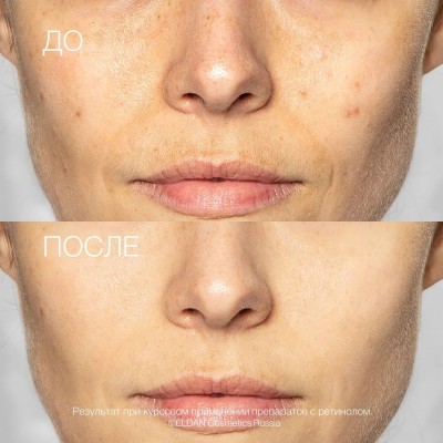 Восстанавливающая маска для лица с ретинолом 0,5% ELDAN RETINOL AGE PERFECT обновление кожи 200 мл